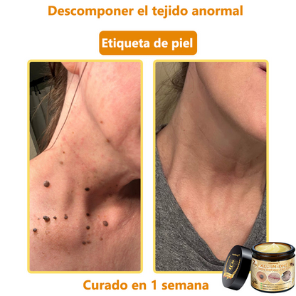 [Tienda Oficial de la Marca] ✨𝐀𝐞𝐞𝐡𝐟𝐞𝐧𝐠™ 𝐂𝐫è𝐚𝐦𝐚 𝐝𝐞 𝐕𝐢𝐧𝐨 𝐝𝐞 𝐇𝐨𝐧𝐝𝐚 𝐂𝐨𝐦𝐩𝐥𝐞𝐭𝐚 𝐝𝐞 𝐝𝐢𝐯𝐞𝐫𝐬𝐨𝐬 𝐧𝐮𝐞𝐬𝐭𝐫𝐨𝐬 𝐂𝐨𝐧𝐟𝐨𝐫𝐦𝐚𝐝𝐨 𝐩𝐨𝐫 𝐝𝐞𝐫𝐦𝐚𝐭𝐨𝐥𝐨𝐠𝐨𝐬 𝐝𝐞 𝐂𝐚𝐧𝐚𝐝𝐚 (👩‍⚕️𝐑𝐞𝐜𝐨𝐦𝐞𝐧𝐝𝐚𝐝𝐨 𝐩𝐨𝐫 A𝐀D).