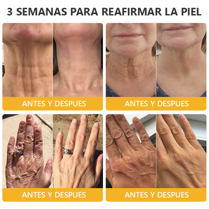 Ungüento de Veneno de Abeja con Retinol para la Piel 🎉𝐀𝐀𝐃 𝐑𝐄𝐂𝐎𝐌𝐈𝐄𝐍𝐃𝐀 (¡55% de Descuento por Tiempo Limitado!)
