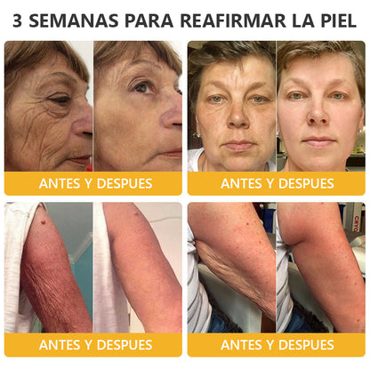 Ungüento de Veneno de Abeja con Retinol para la Piel 🎉𝐀𝐀𝐃 𝐑𝐄𝐂𝐎𝐌𝐈𝐄𝐍𝐃𝐀 (¡55% de Descuento por Tiempo Limitado!)