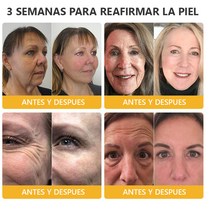 Ungüento de Veneno de Abeja con Retinol para la Piel 🎉𝐀𝐀𝐃 𝐑𝐄𝐂𝐎𝐌𝐈𝐄𝐍𝐃𝐀 (¡55% de Descuento por Tiempo Limitado!)