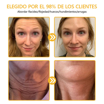Ungüento de Veneno de Abeja con Retinol para la Piel 🎉𝐀𝐀𝐃 𝐑𝐄𝐂𝐎𝐌𝐈𝐄𝐍𝐃𝐀 (¡55% de Descuento por Tiempo Limitado!)