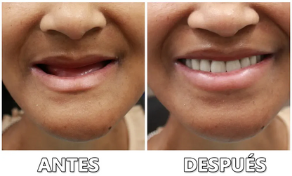 Sitio web oficial: Bikenda™ Kit para prótesis dentales de silicona🏅Recomendado por la Asociación Dental Mexicana🎁