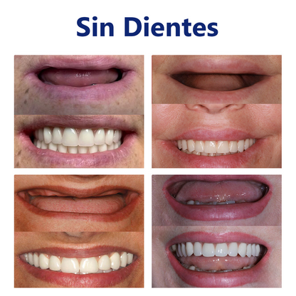 𝐵𝑖𝑘𝑒𝑛𝑑𝑎™ 𝑆𝑖𝑙𝑖𝑐𝑜𝑛𝑒 𝐷𝑒𝑛𝑡𝑢𝑟𝑒 𝑅𝑢𝑙𝑒𝑟 𝑆𝑒𝑡🎁 (👩‍⚕️Reconocido por la Asociación Dental Mexicana y aprobado por COFEPRIS)