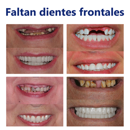 𝐵𝑖𝑘𝑒𝑛𝑑𝑎™ 𝑆𝑖𝑙𝑖𝑐𝑜𝑛𝑒 𝐷𝑒𝑛𝑡𝑢𝑟𝑒 𝑅𝑢𝑙𝑒𝑟 𝑆𝑒𝑡🎁 (👩‍⚕️Reconocido por la Asociación Dental Mexicana y aprobado por COFEPRIS)