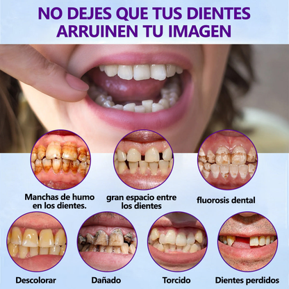 𝐵𝑖𝑘𝑒𝑛𝑑𝑎™ 𝑆𝑖𝑙𝑖𝑐𝑜𝑛𝑒 𝐷𝑒𝑛𝑡𝑢𝑟𝑒 𝑅𝑢𝑙𝑒𝑟 𝑆𝑒𝑡🎁 (👩‍⚕️Reconocido por la Asociación Dental Mexicana y aprobado por COFEPRIS)