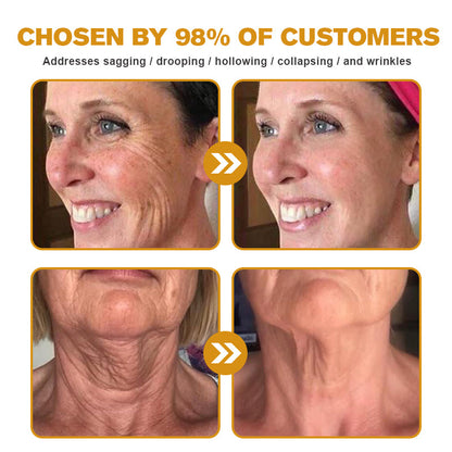 Hecho y enviado desde EE. UU. ✅ Crema para eliminar arrugas TLOPA™ Botox con veneno de abeja - ÚLTIMO DÍA 80% DE DESCUENTO