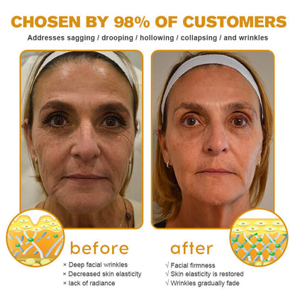 Hecho y enviado desde EE. UU. ✅ Crema para eliminar arrugas TLOPA™ Botox con veneno de abeja - ÚLTIMO DÍA 80% DE DESCUENTO
